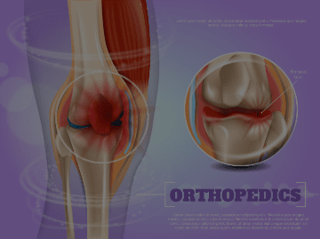 Medial Meniscus Tear